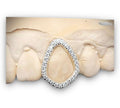 Openface Diamond tooth