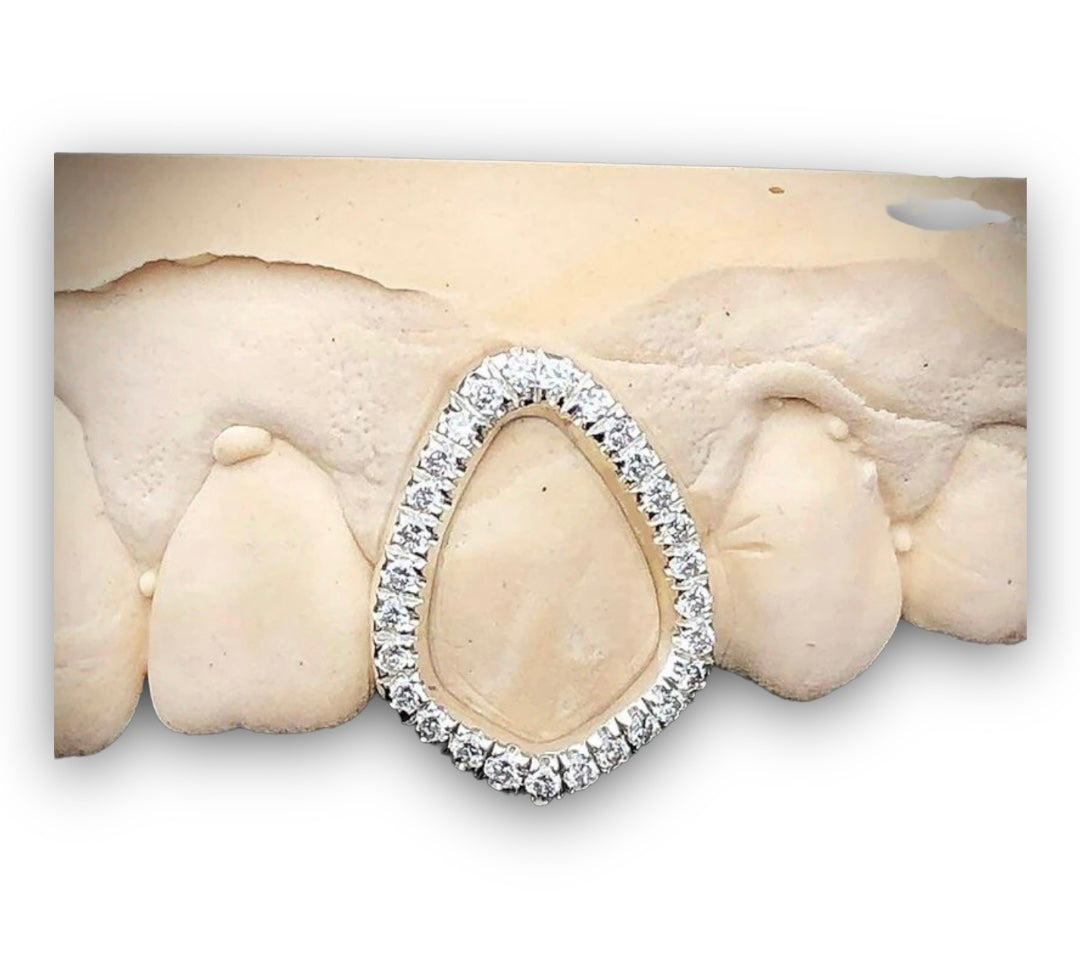 Openface Diamond tooth